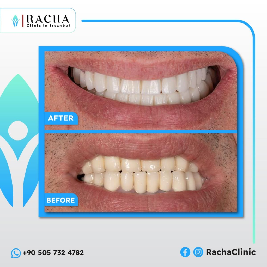 1. Dental Treatment