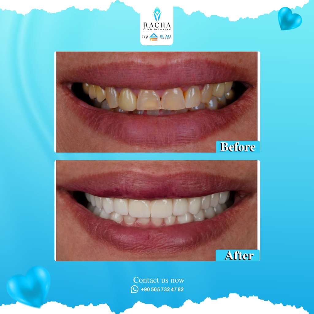 12. Dental Treatment EN