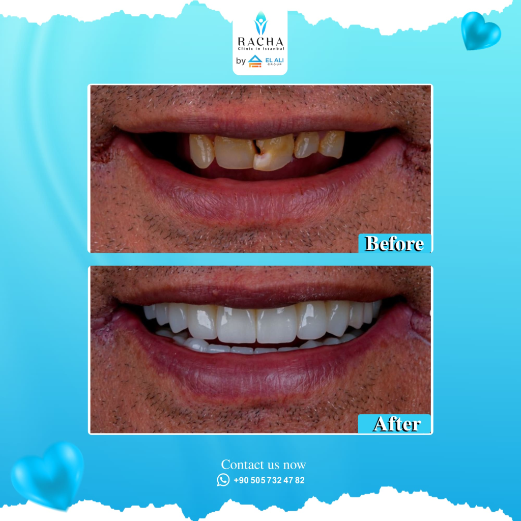 14. Dental Treatment EN