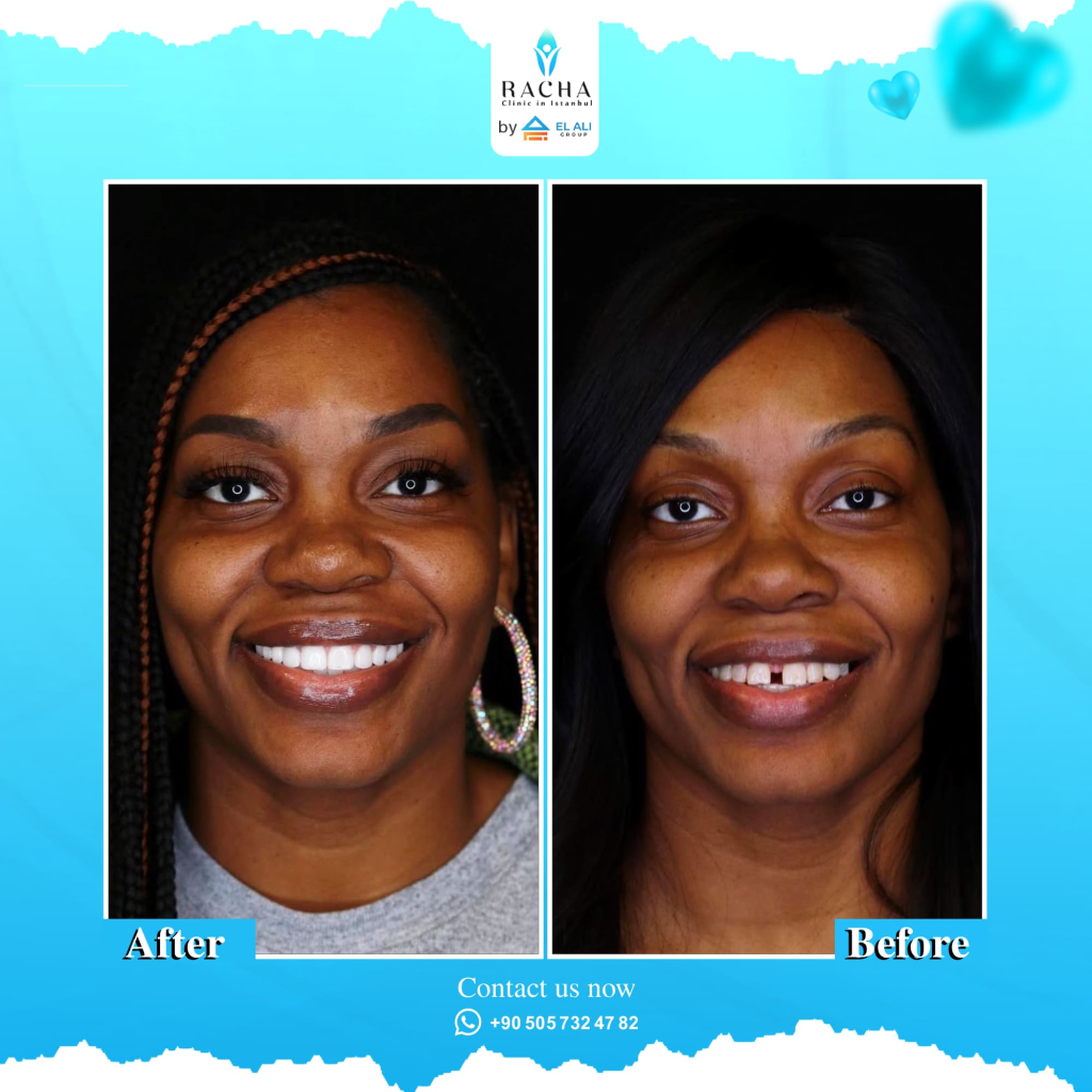 18.-Dental-Treatment-EN-Copy.webp