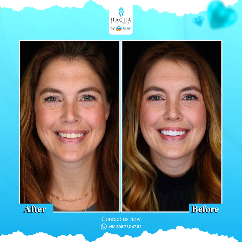 19.-Dental-Treatment-EN-Copy.webp
