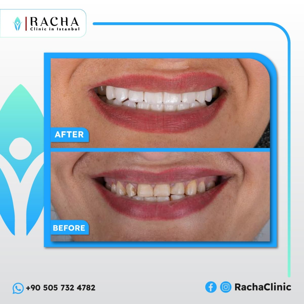 2. Dental Treatment - Copy