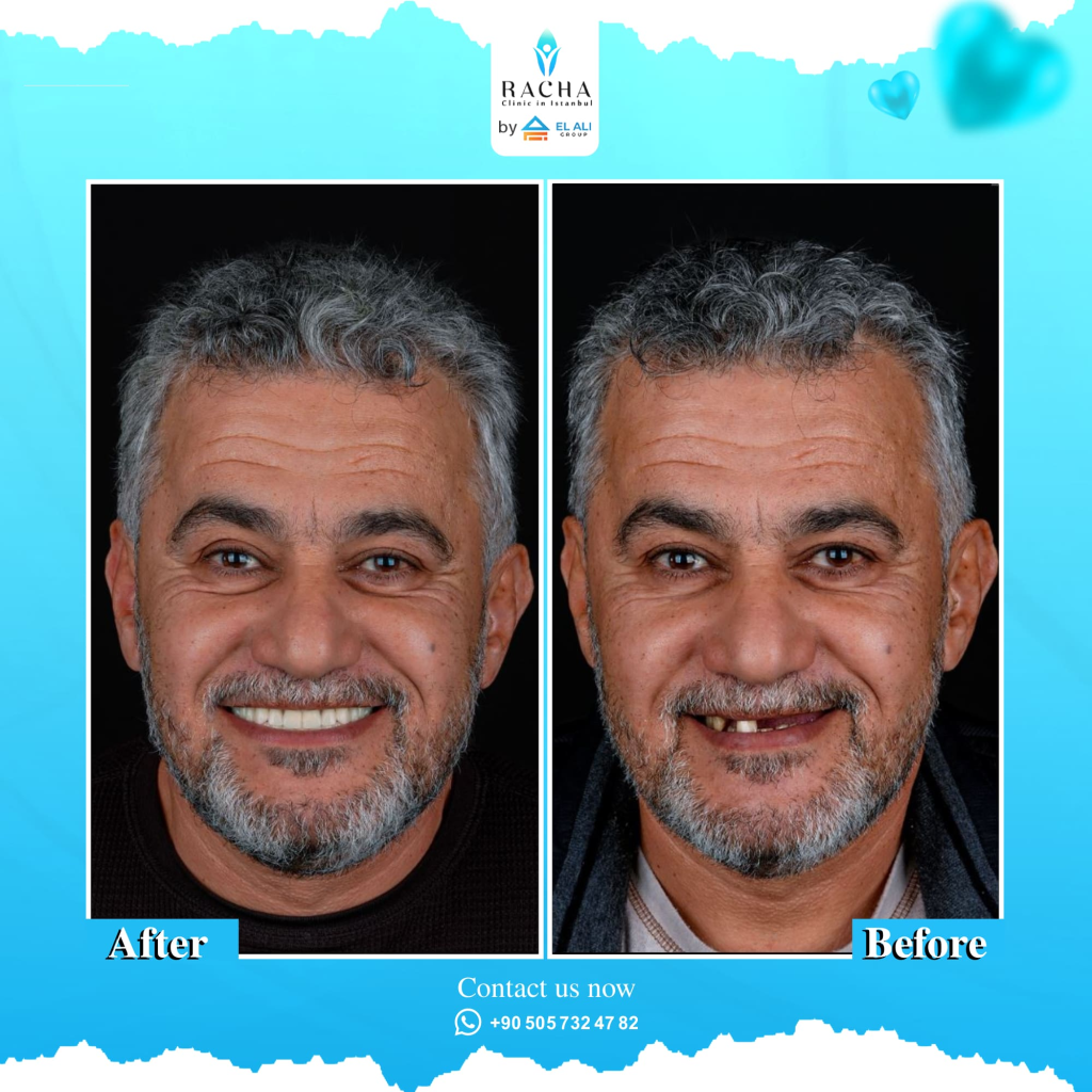 20.-Dental-Treatment-EN-Copy.webp