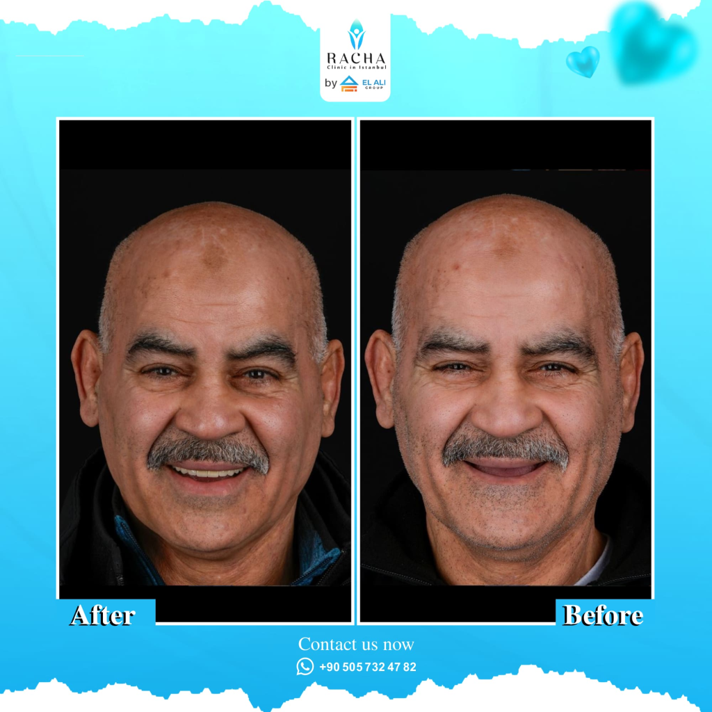 21.-Dental-Treatment-EN.webp