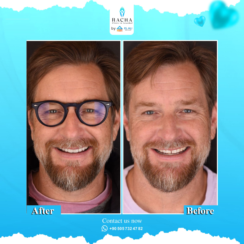 23.-Dental-Treatment-EN-Copy-Copy.webp
