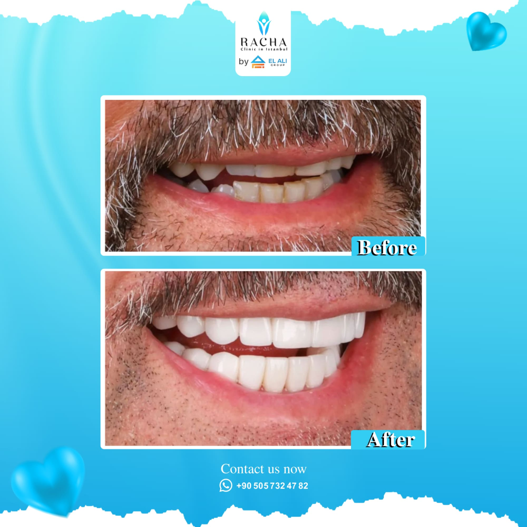 26. Dental Treatment EN