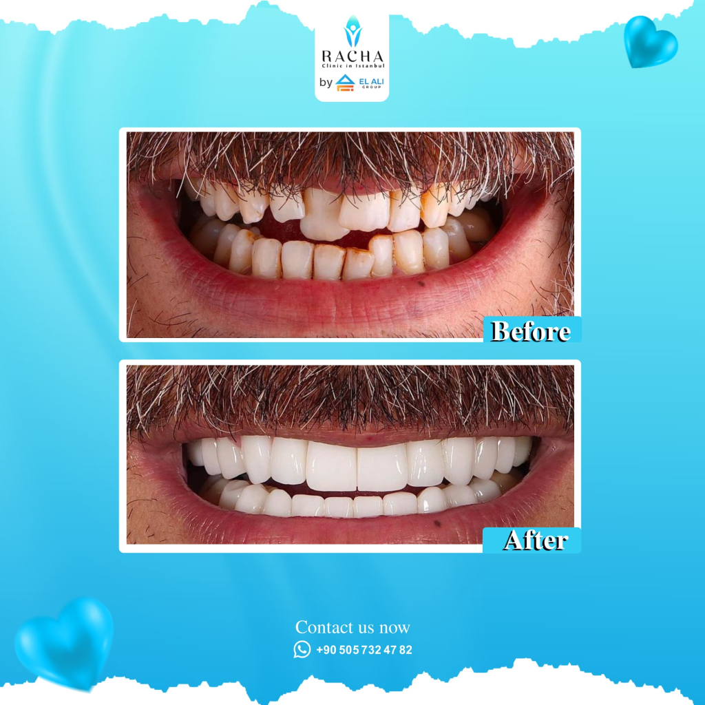 29. Dental Treatment EN