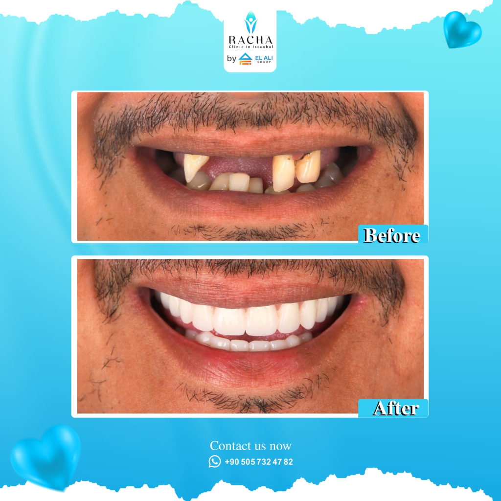 31. Dental Treatment EN