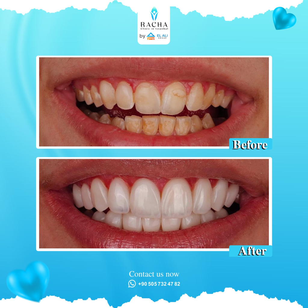 32. Dental Treatment EN