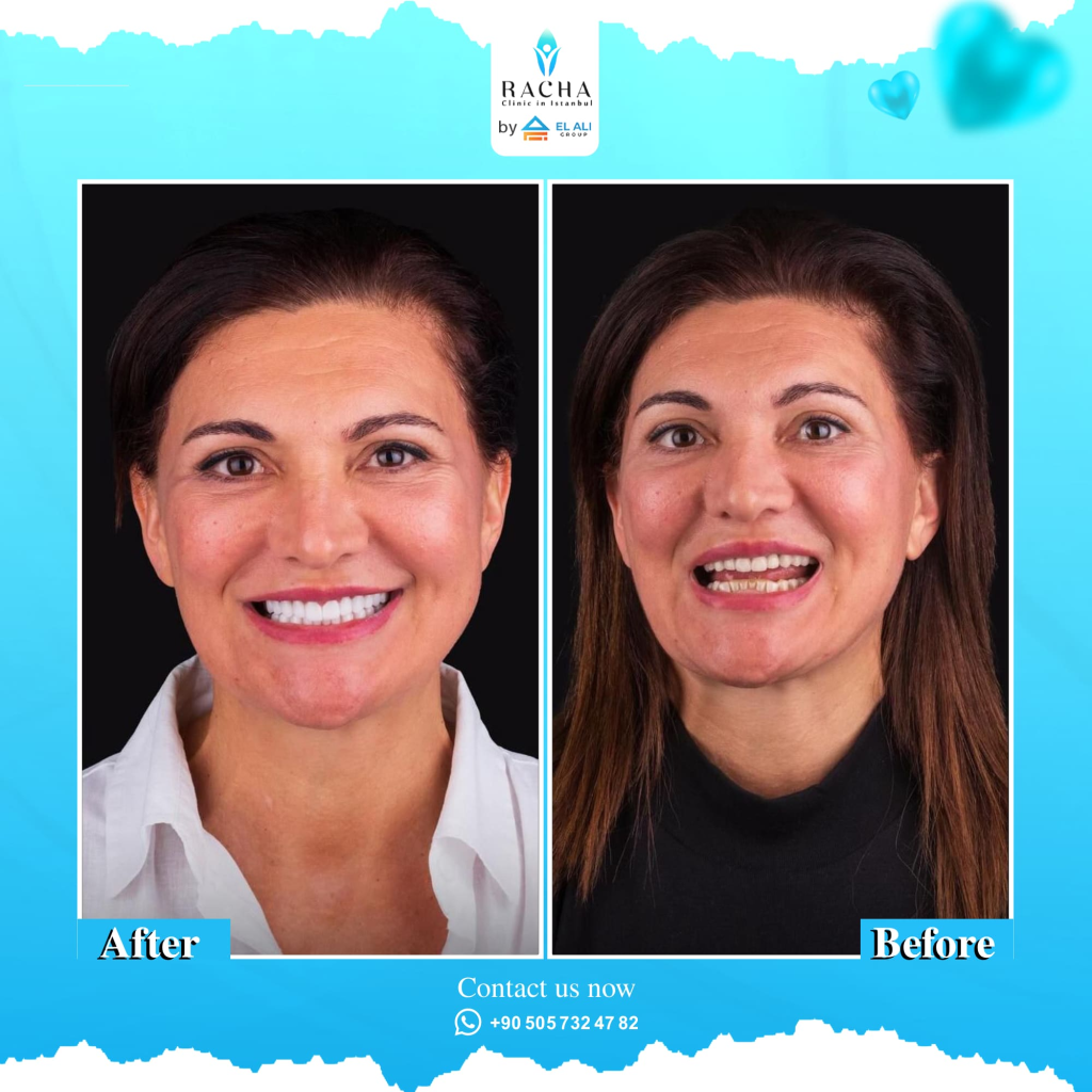 35.-Dental-Treatment-EN.webp