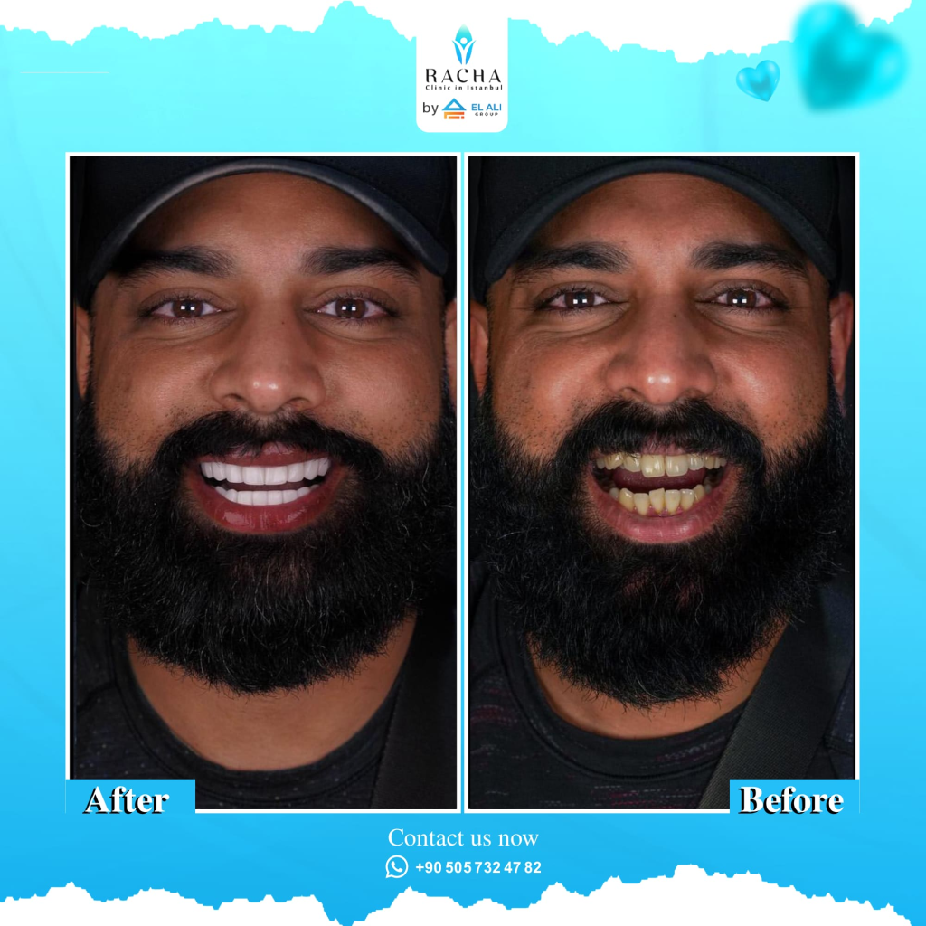 36.-Dental-Treatment-EN.webp