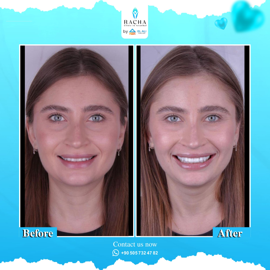39. Dental Treatment EN