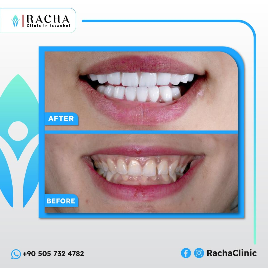 7. Dental Treatment